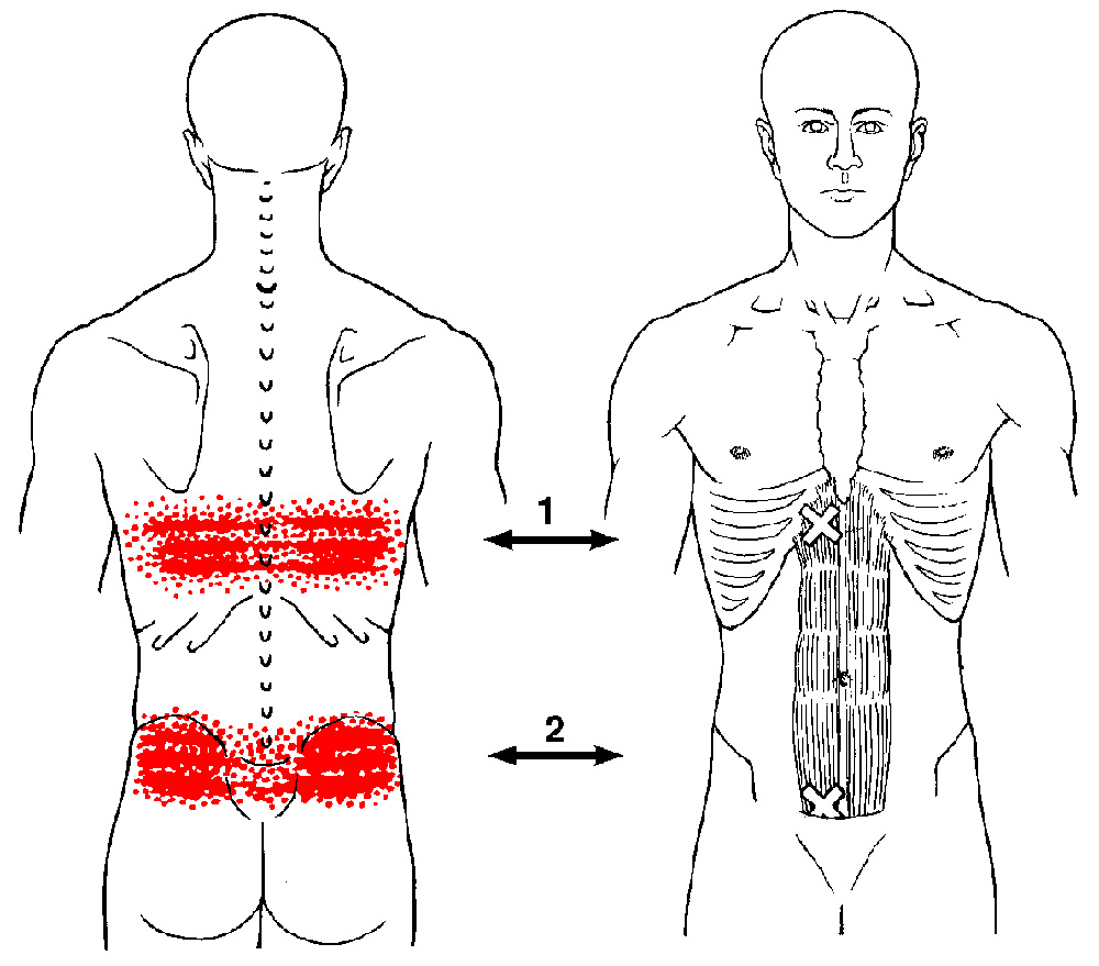 What Causes A Wide Band Of Pain In Your Back SIMPLE BACK PAIN RELIEF 